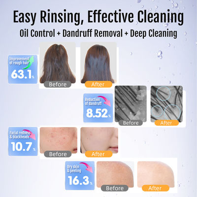 Ultra ince kabarcık üreticisi 0.1-50 Mikronluk kabarcık boyutu ile % 300 böcek ilacı kalıntısı çıkarma ve 100 milyon kabarcık/ml derin gözenek temizliği